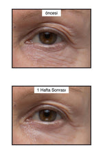 Murad Renewing Eye Cream 15ml - Anti-Aging Moisturizing Eye Cream for Fine Lines & Wrinkles